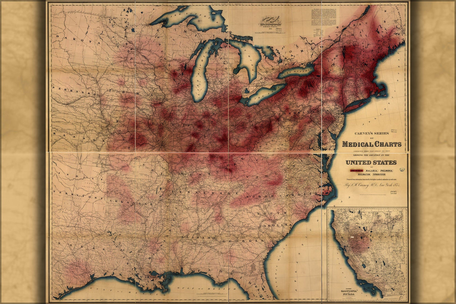 Poster, Many Sizes Available; Map Of Phthisis Or Tuberculosis In United States Of America 1874