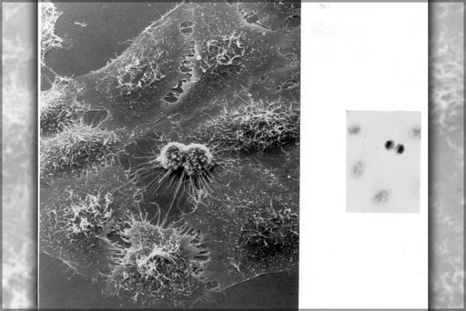 Poster, Many Sizes Available; Hela Cells Dividing Under Electron Microscopy Henrietta Lacks