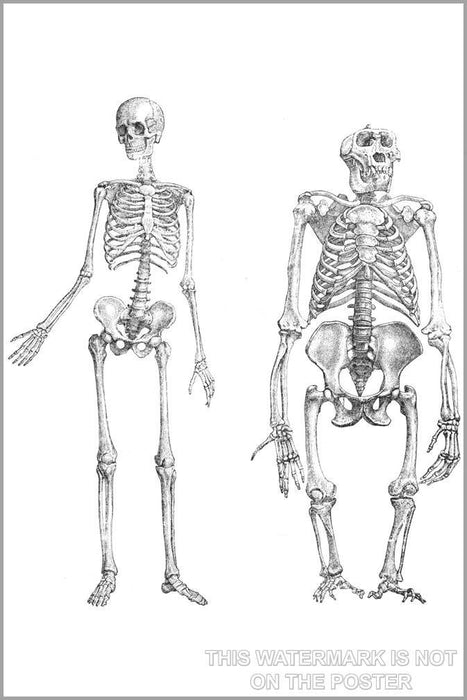 Poster, Many Sizes Available; Skeleton Of Human (1) And Gorilla (2), Unnaturally Stretched