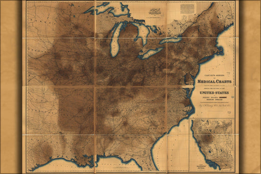 Poster, Many Sizes Available; Map Of Pneumonia In United States Of America 1874