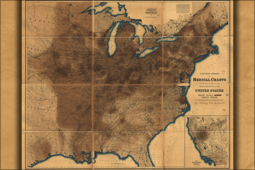 24"x36" Gallery Poster, map of pneumonia in united states of america 1874