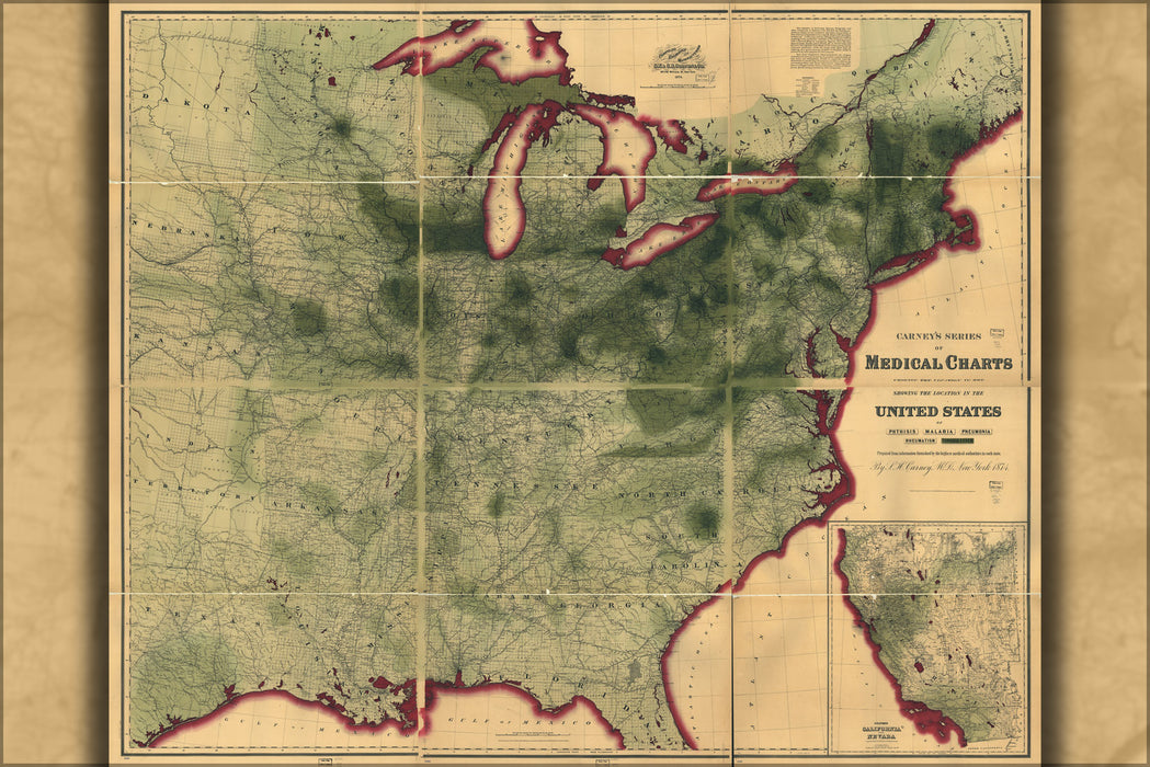 24"x36" Gallery Poster, map of typhoid fever in united states of america 1874